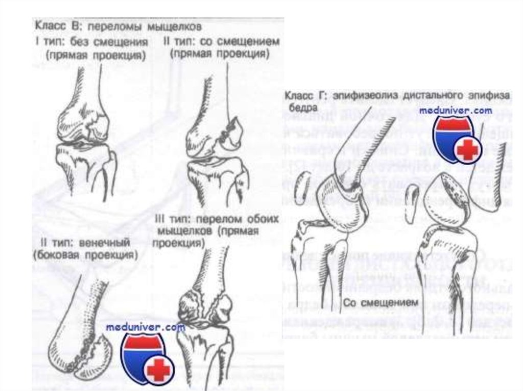 Повреждение органов брюшной полости - презентация онлайн
