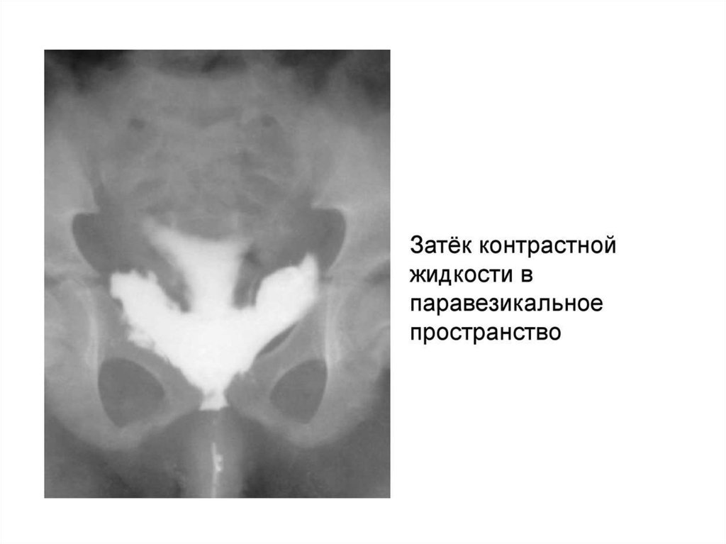 Повреждение органов брюшной полости - презентация онлайн