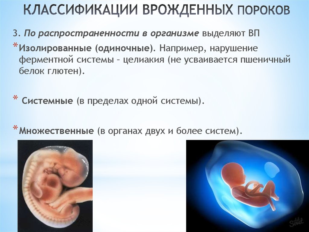 КЛАССИФИКАЦИИ ВРОЖДЕННЫХ ПОРОКОВ