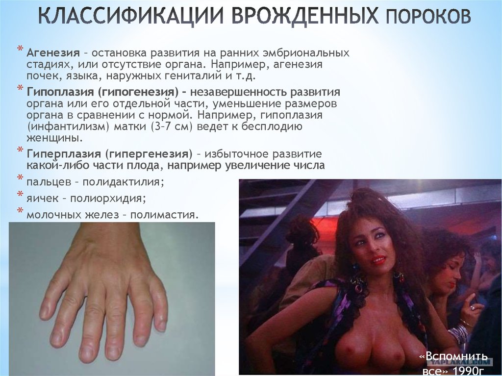 КЛАССИФИКАЦИИ ВРОЖДЕННЫХ ПОРОКОВ