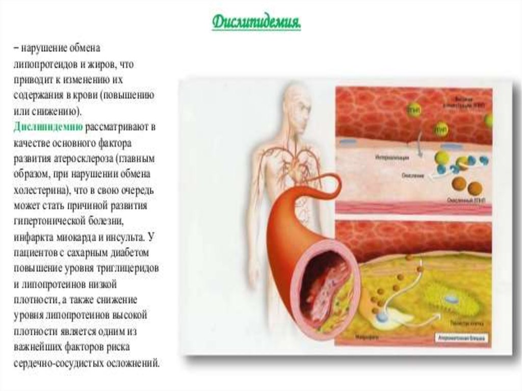 Профилактика атеросклероза презентация