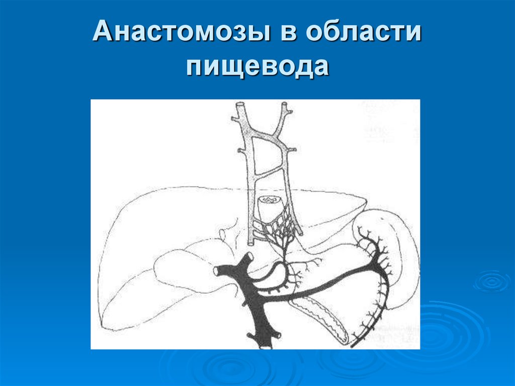 Анастомоз пищевода
