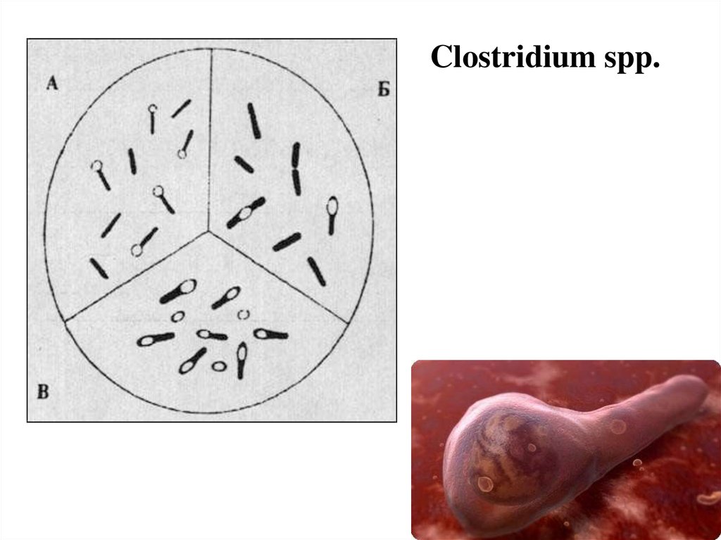 Кластридии. Clostridium pasteurianum по Граму. Бактерии рода Clostridium. Клостридии в микроскопе. Клостридии представители.