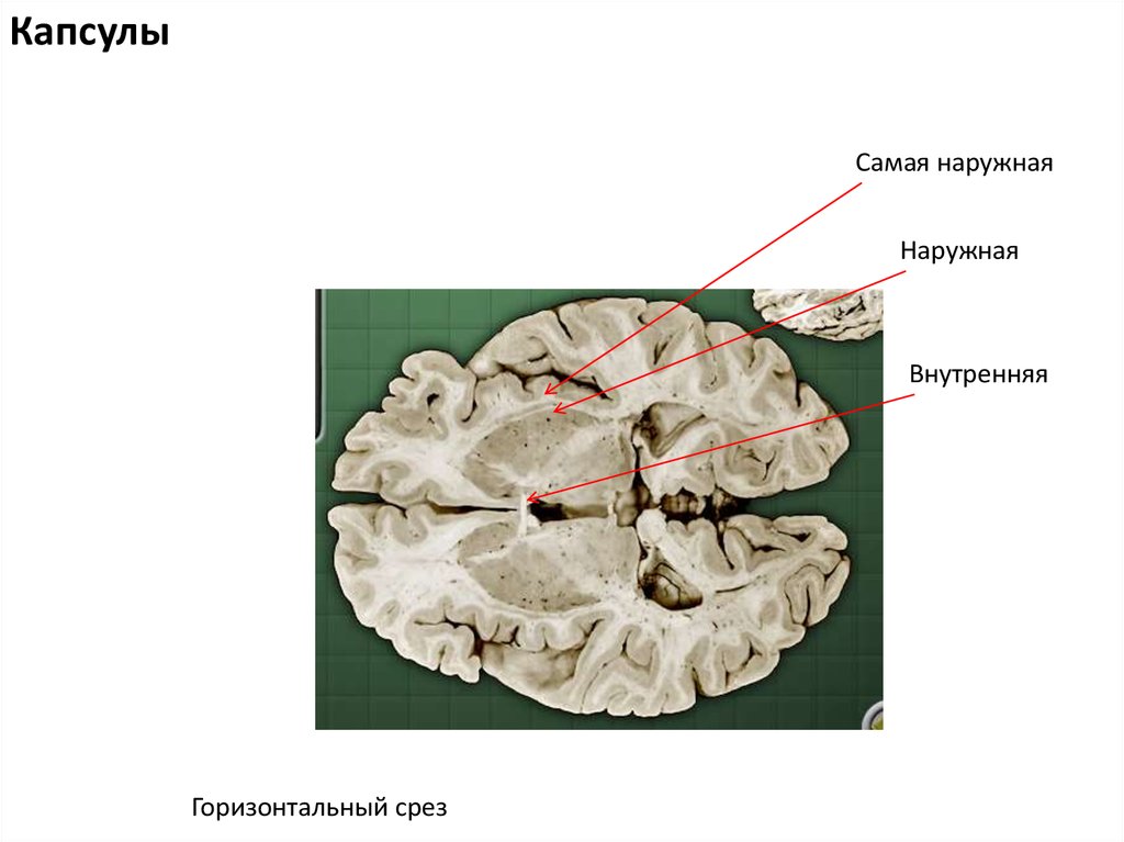 Внутренней горизонтальной. Внутренняя и наружная капсула. Базальные ядра наружная капсула. Наружная капсула латынь. Самая наружная капсула конечный мозг.
