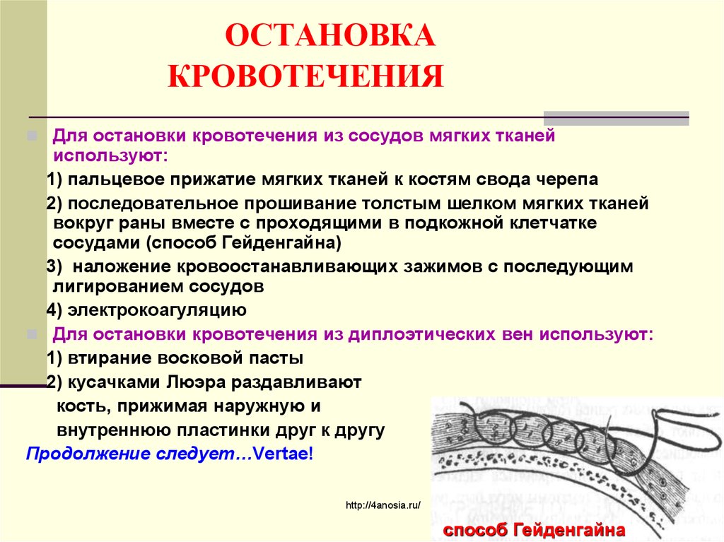 Основные способы остановки кровотечения головы. Способы остановки кровотечения из костей черепа. Способы остановки кровотечения топографическая анатомия. Способы остановки кровотечения из диплоэтических вен. Способы остановки кровотечения из костей свода черепа.