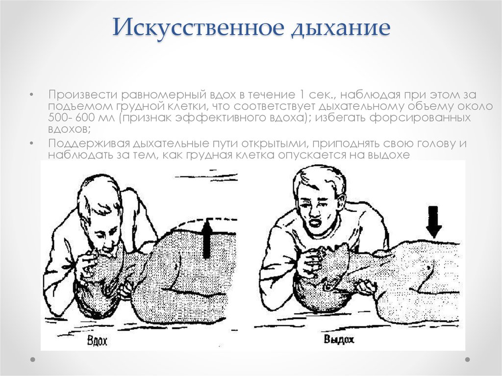 Искусственное дыхание признаки