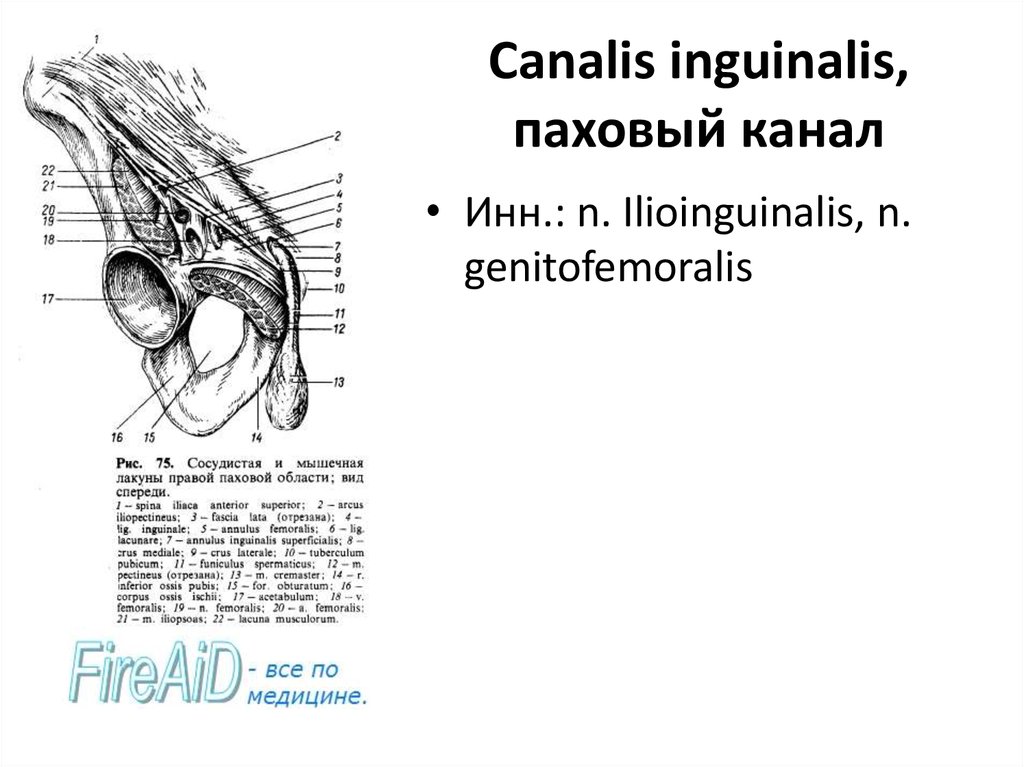 Паховый канал. Canalis inguinalis стенки. Паховый канал, Canalis inguinalis:. Задняя стенка пахового канала (Canalis inguinalis) образована:. (Canalis inguinalis) кадавер.