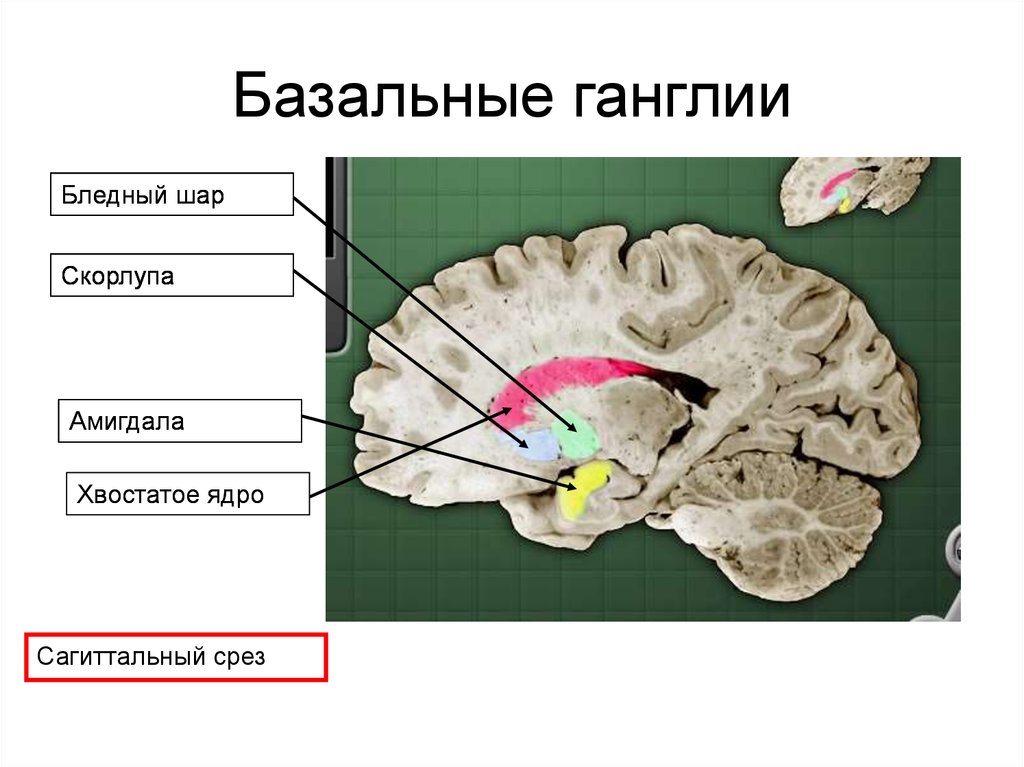 Изменение в базальных отделах. Базальные ганглии головного мозга. Базальные ганглии головного мозга анатомия. Хвостатое ядро базальных ганглиев. Базальные ганглии конечного мозга.