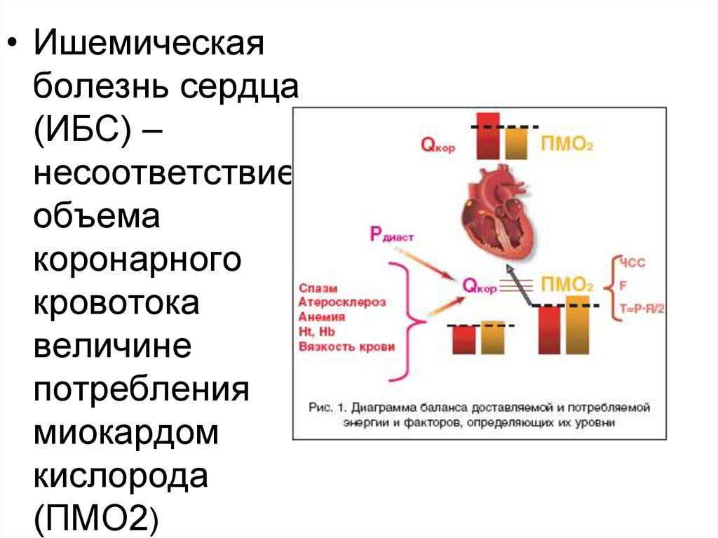 Отеки при ишемической болезни сердца