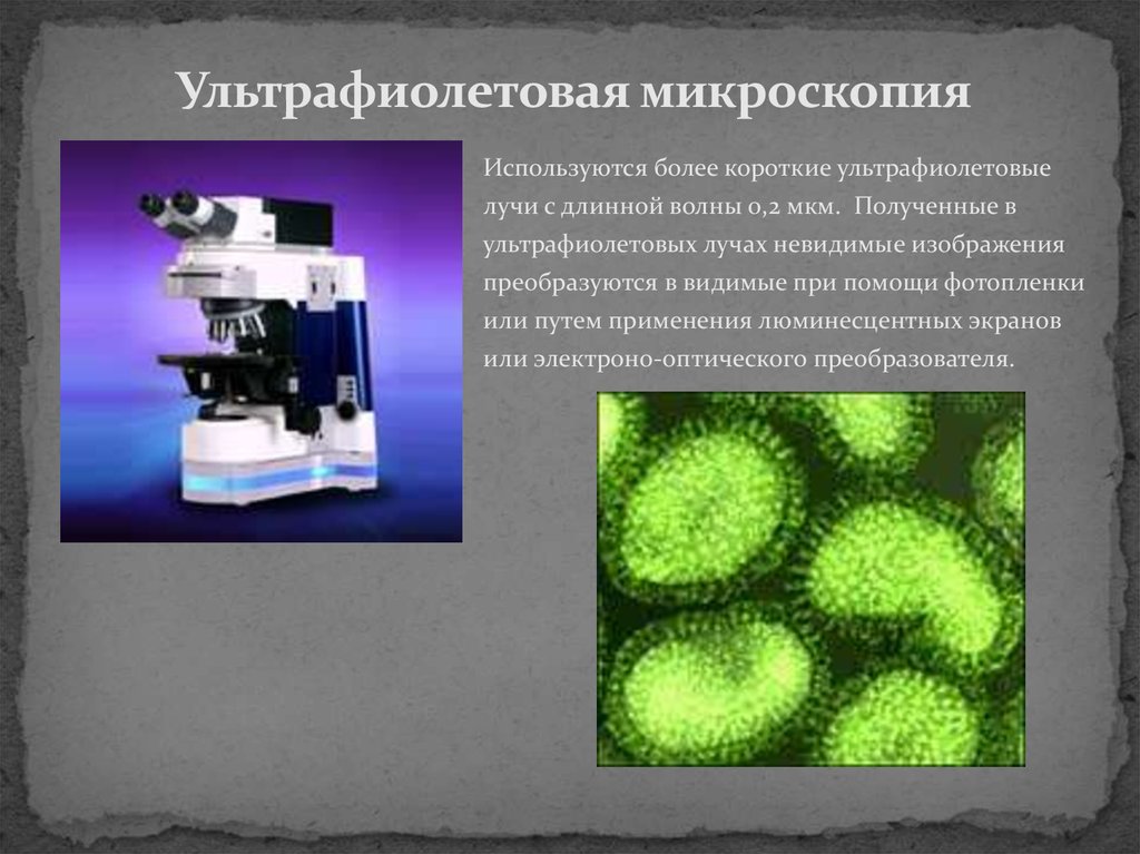 Микроскопией называют метод микроскопии. Ультрафиолетовая микроскопия микрофотографии. Люминесцентная микроскопия микробиология. Ультрафиолетовая микроскопия препарат гистология. Интерференционная микроскопия гистология.