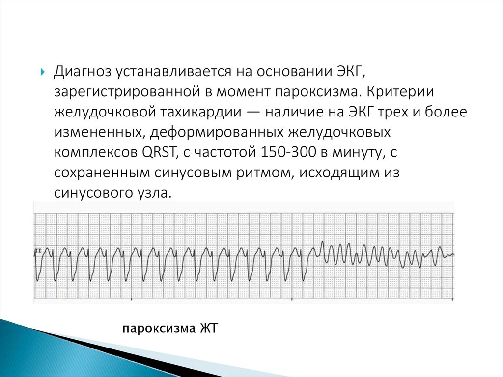 Жт типа пируэт картинки