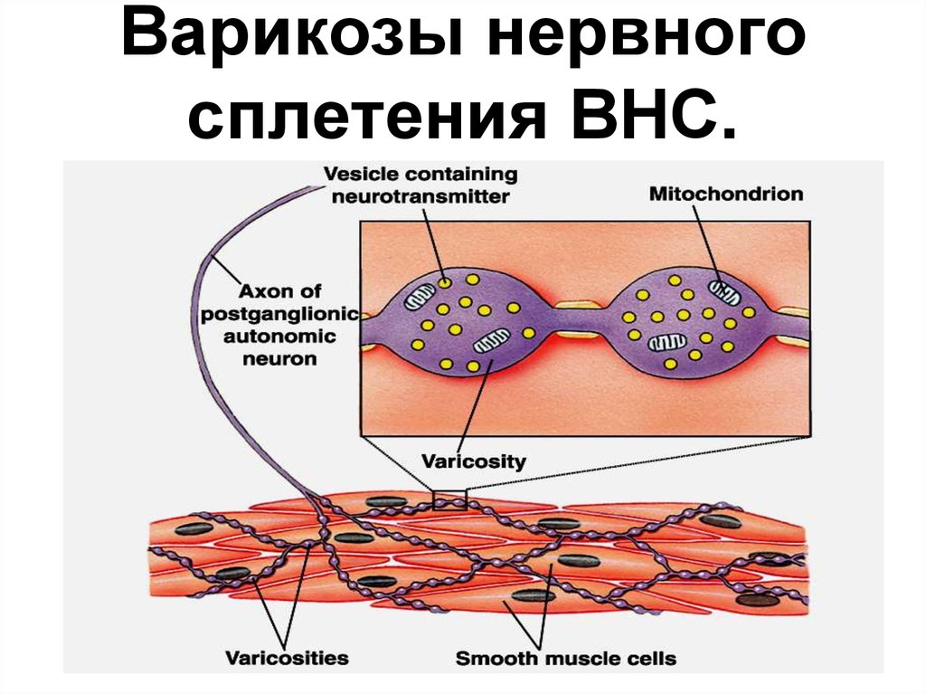 Варикоз корнилова схема