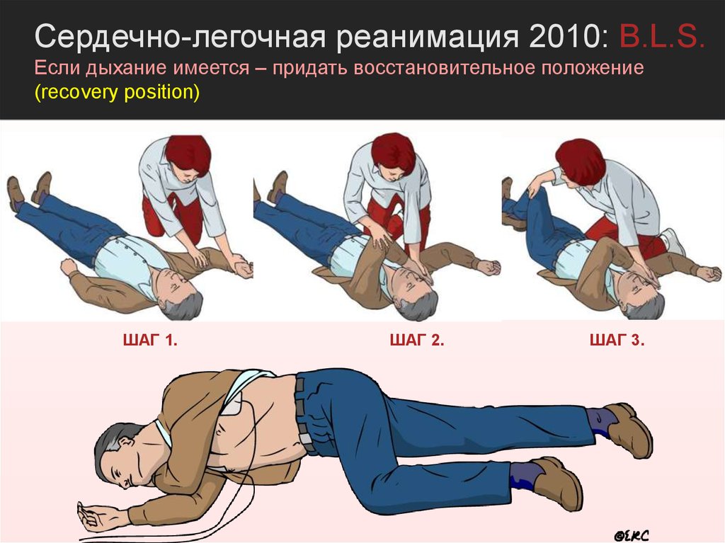 Правильное проведение сердечно легочной реанимации. Сердечно-лёгочная реанимация. Сердеснолегочная реанимация. Сердечно легочная реанимаци. Сердечнолегочная реанимаци.