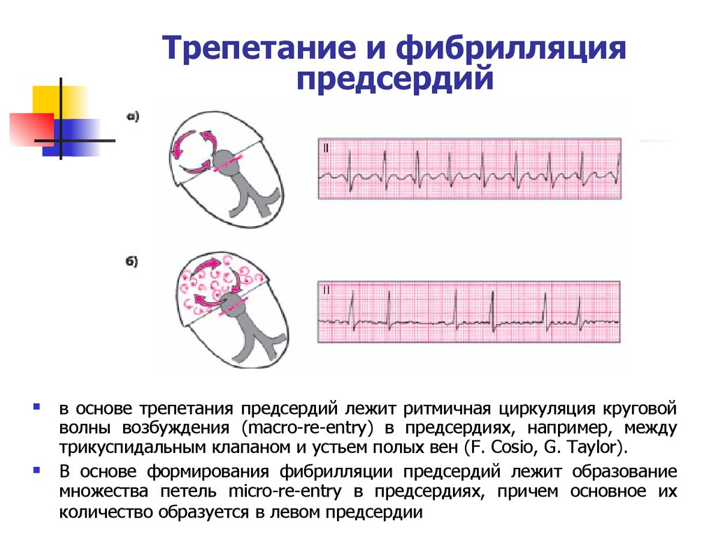 Физические основы электрокардиографии презентация