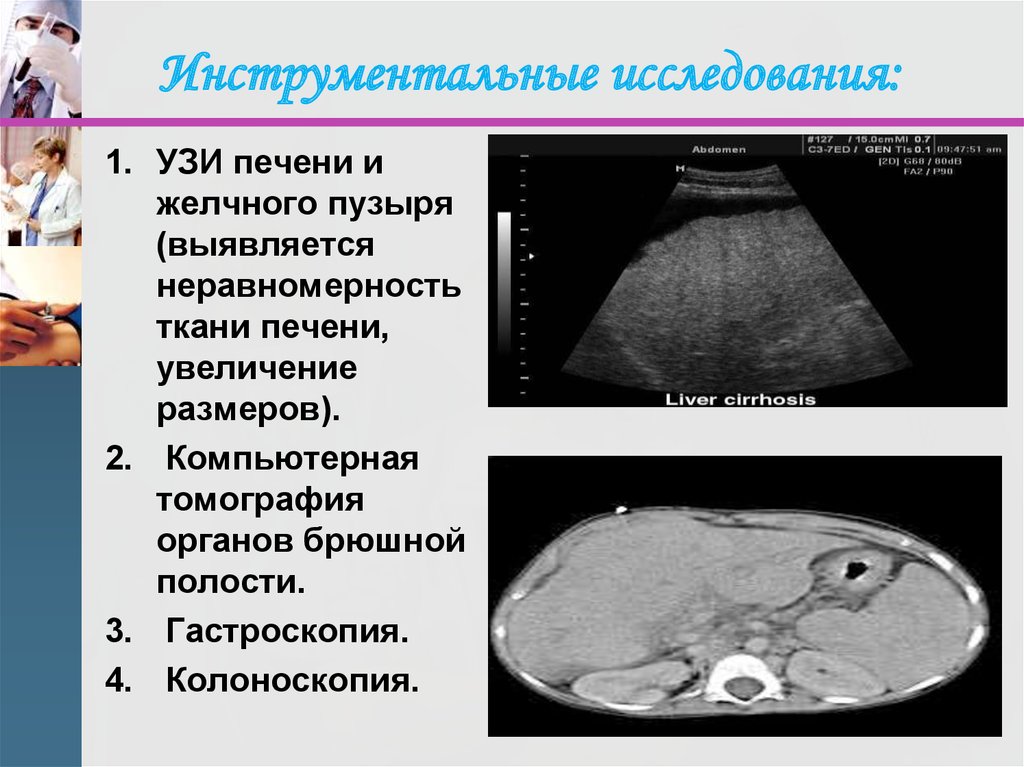 Увеличенная печень на узи. УЗИ печени презентация. УЗИ печени слайдам.