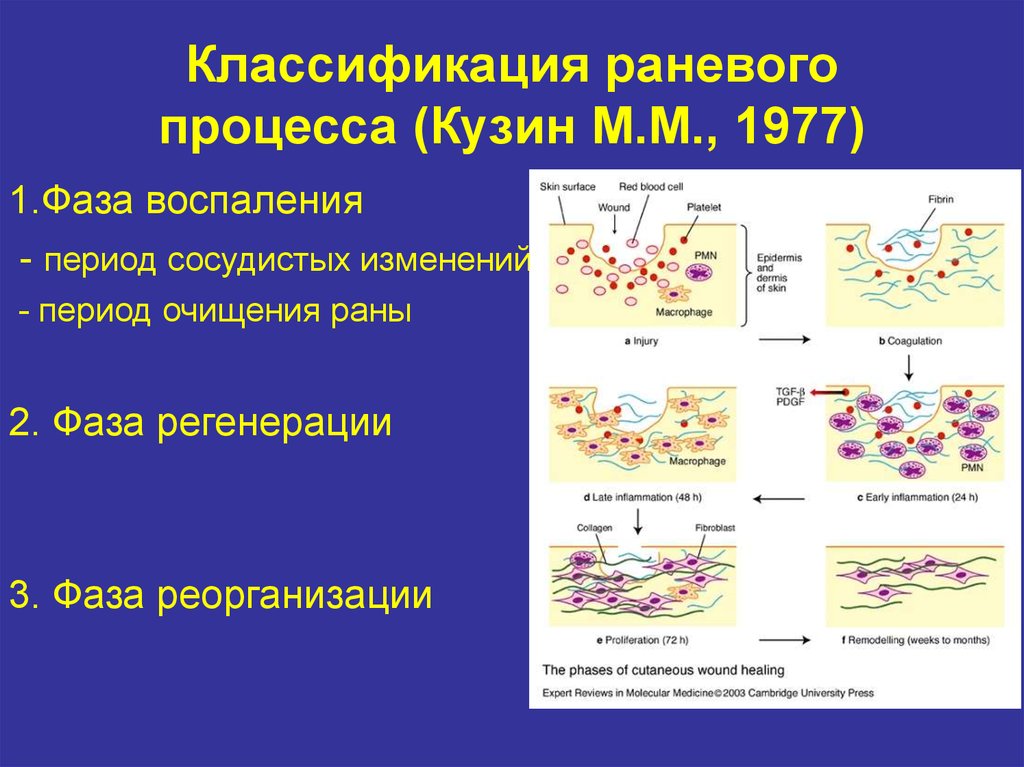 Классификация раневого процесса (Кузин М.М., 1977)