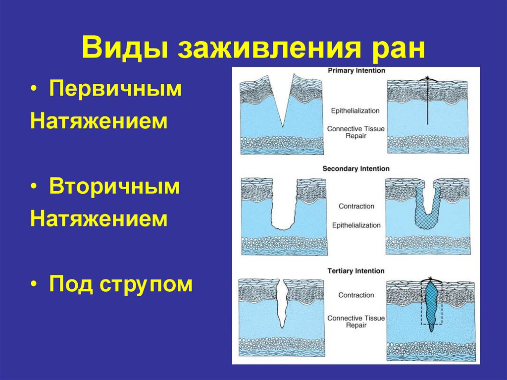 Рана земли