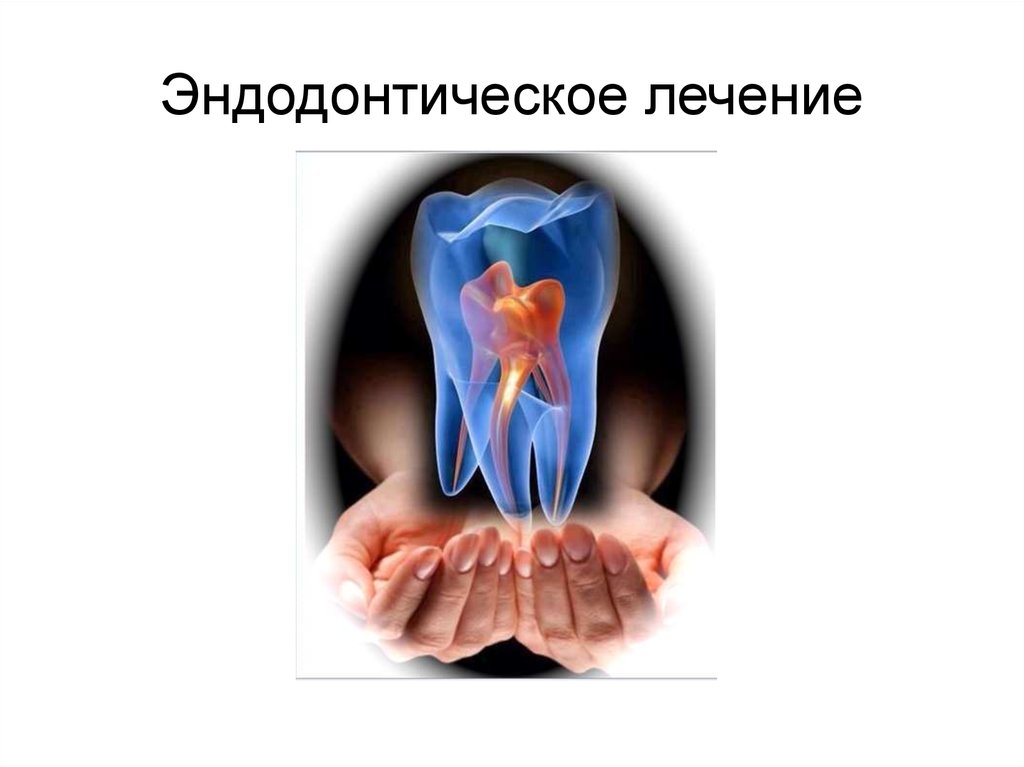 Эндодонтическое лечение. Зуб 26 - презентация онлайн