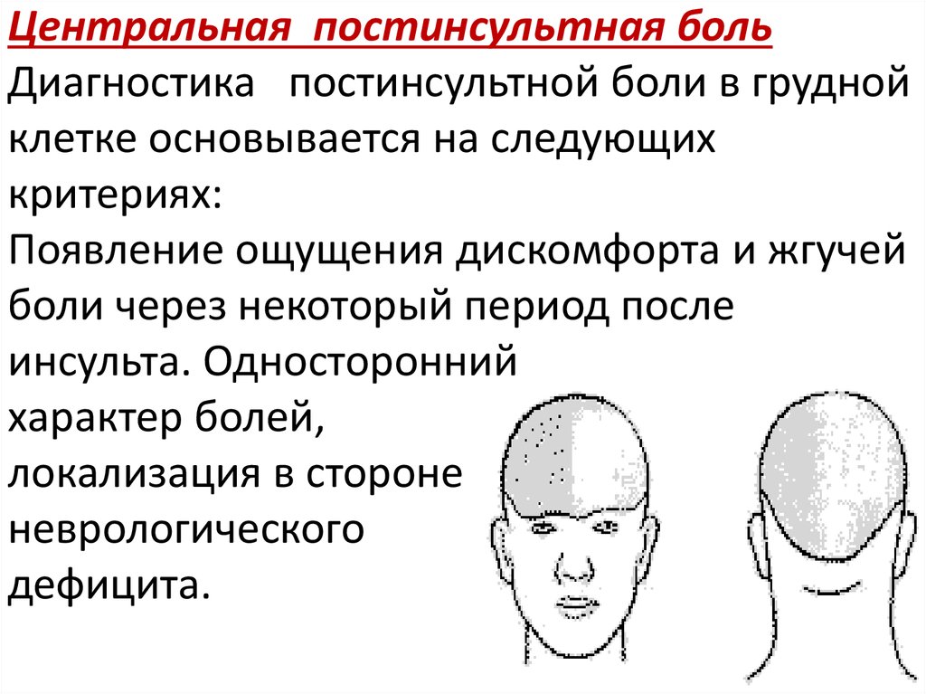 Интенсивность головных болей