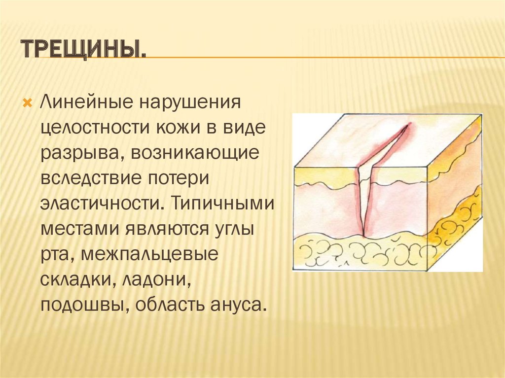 Первичные морфологические элементы презентация