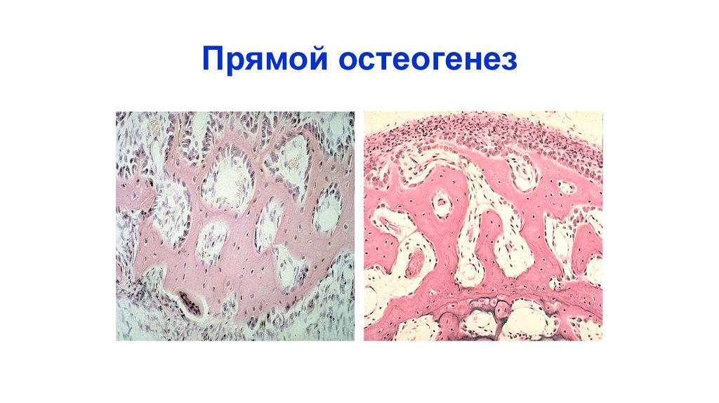 Репаративный остеогенез презентация