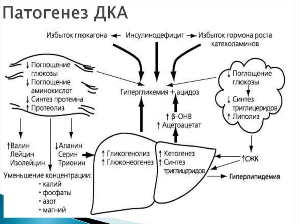 Сахарный диабет мозга. Патогенез диабетического кетоацидоза схемы. Патогенез кетоза при сахарном диабете.. Диабетический кетоацидоз метаболическая схема развития. Диабетический кетоацидоз патогенез.