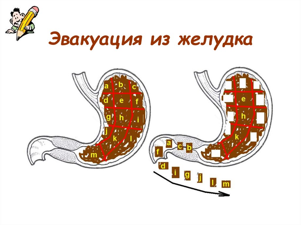 Нарушение эвакуации. Эвакуация желудочного содержимого. Нарушение эвакуации из желудка. Эвакуация пищи из желудка.