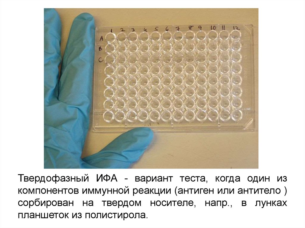 Принцип исследования твердофазный иммуноферментный анализ в 96 луночном планшете