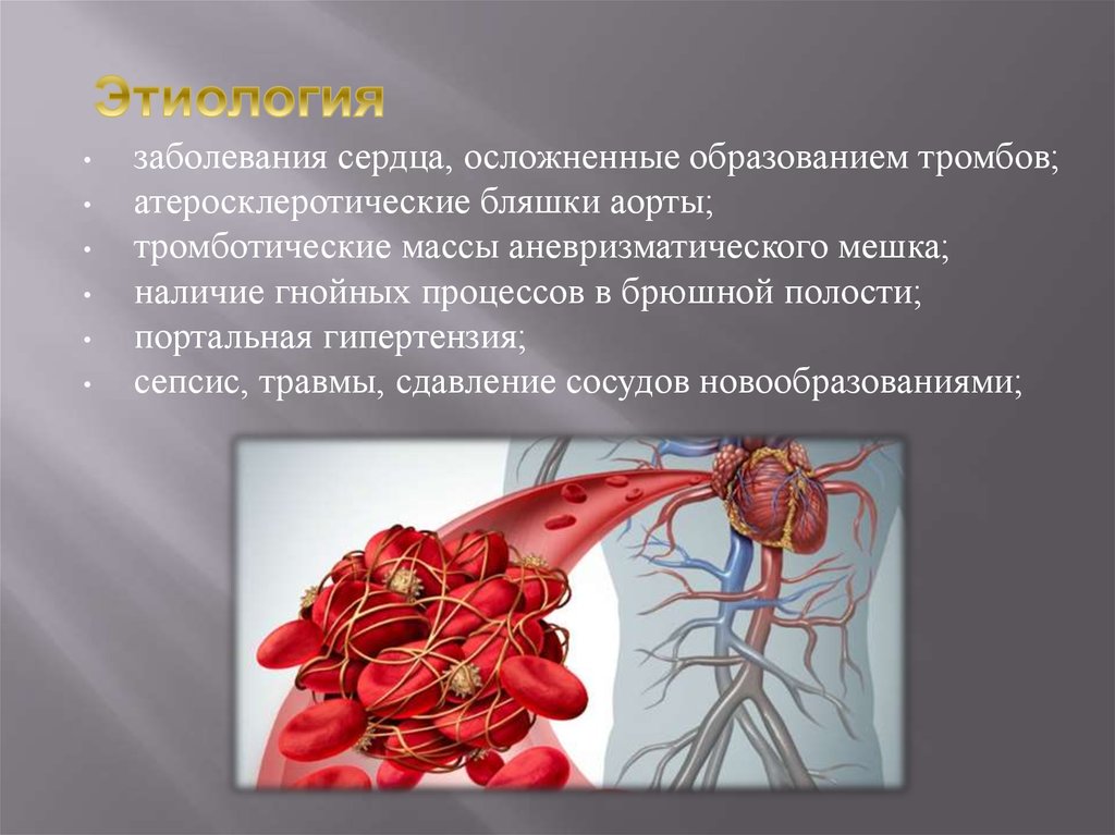 Заболевание сосудов называется. Мезентериальный тромбоз клиника. Образование тромба в сердце. Тромбоз в полостях сердца.