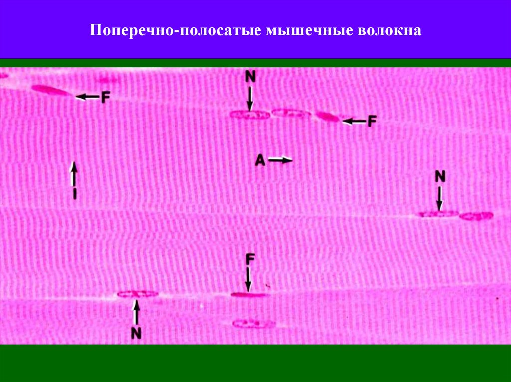 Сокращение поперечно полосатой мускулатуры. Поперечно полосатые волокна. Поперечно полосатое мышечное волокно. Волокна полосатая поперечно полосатая. Поперечно полосатая мышечная ткань ткань.