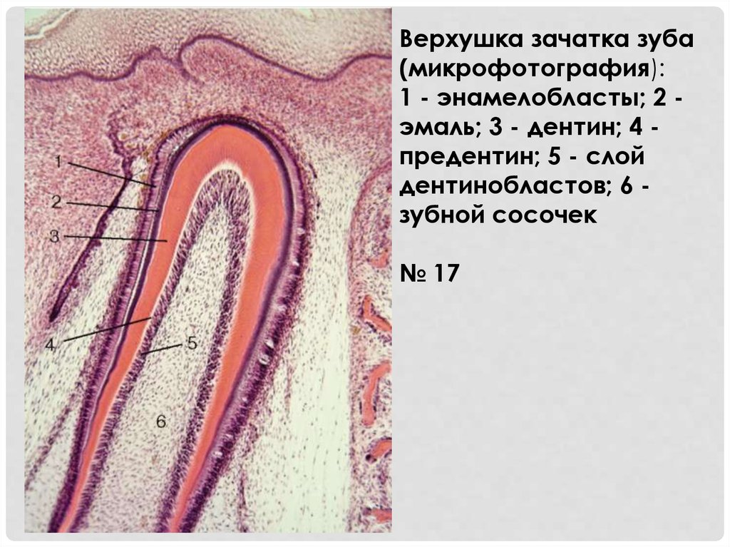 Гистологическое строение тканей зуба. Гистогенез зубных тканей гистология. Дентин микрофотография.
