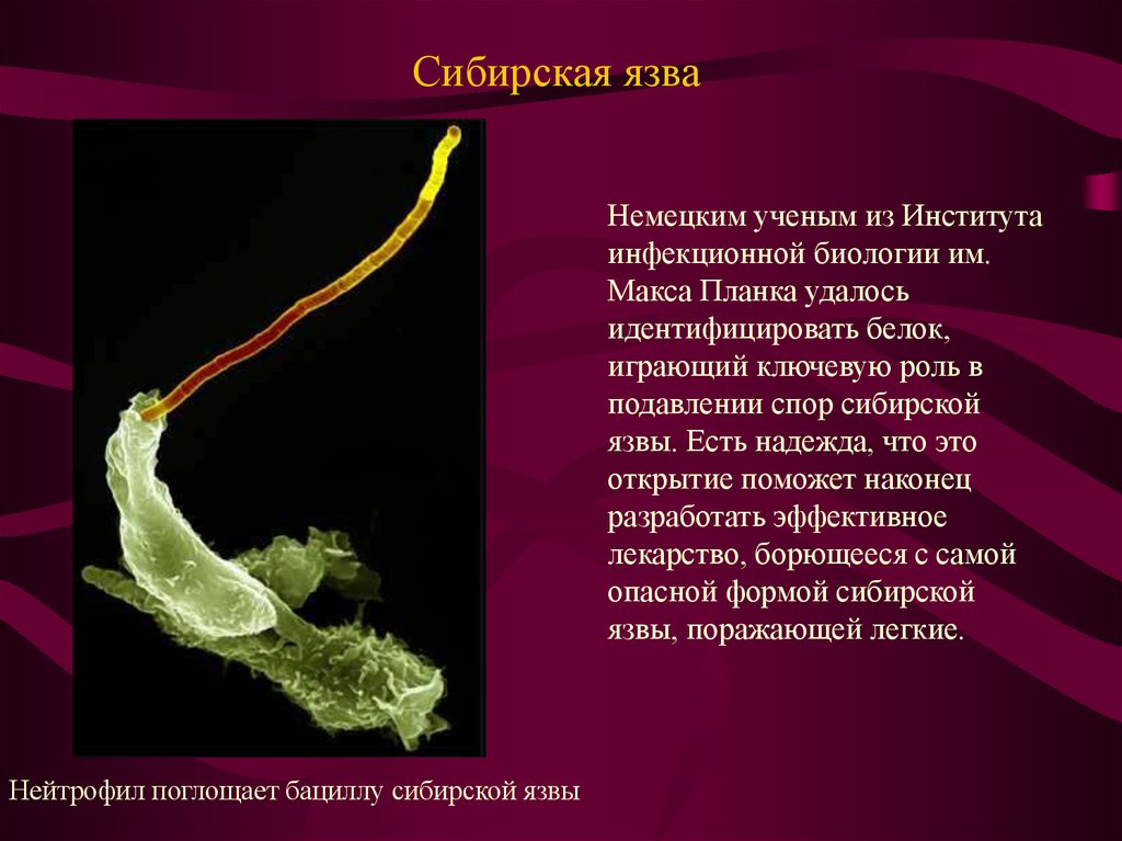 В скотомогильниках бактерии очень опасного заболевания. Сибирская язва презентация. Доклад на тему Сибирская язва.