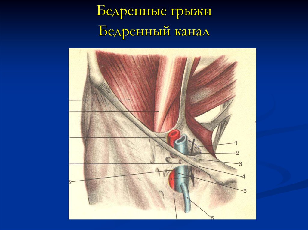 Бедренная щель. Бедренный канал схема топография. Бедренное кольцо топографическая анатомия. Бедренная грыжа анатомия. Стенки бедренного канала топографическая анатомия.