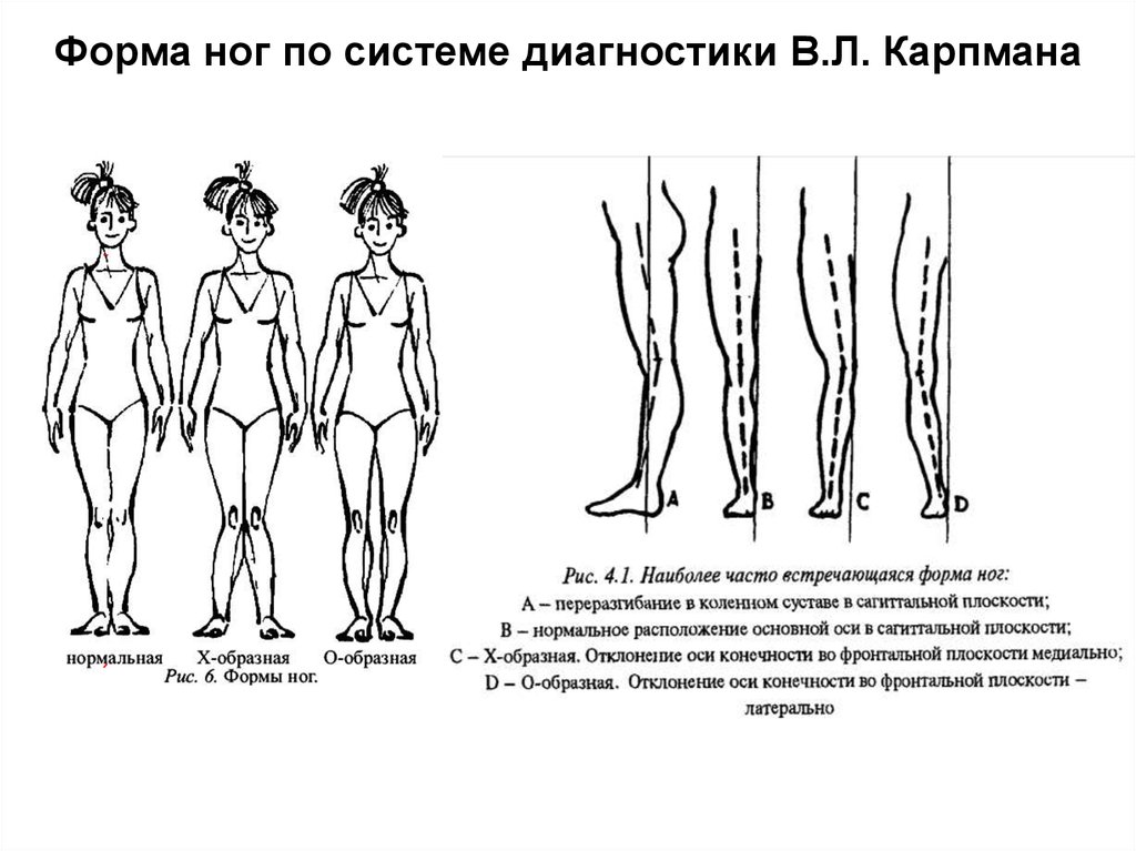 Форма ног по системе диагностики B.Л. Карпмана
