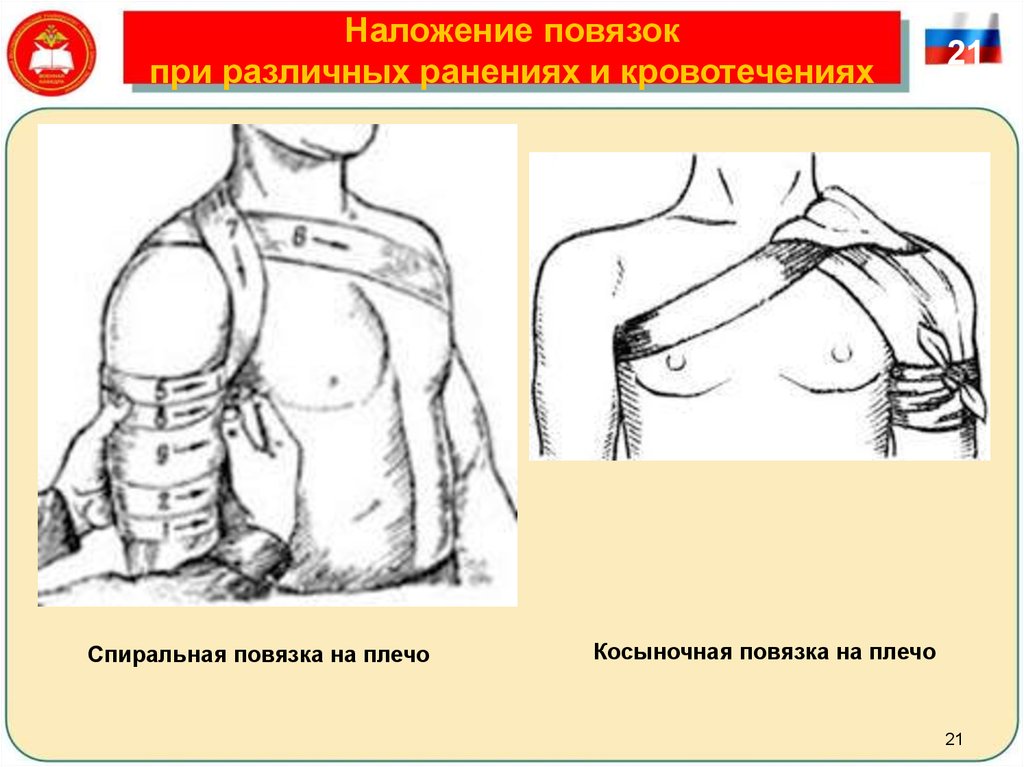 Повязка при ранении плеча