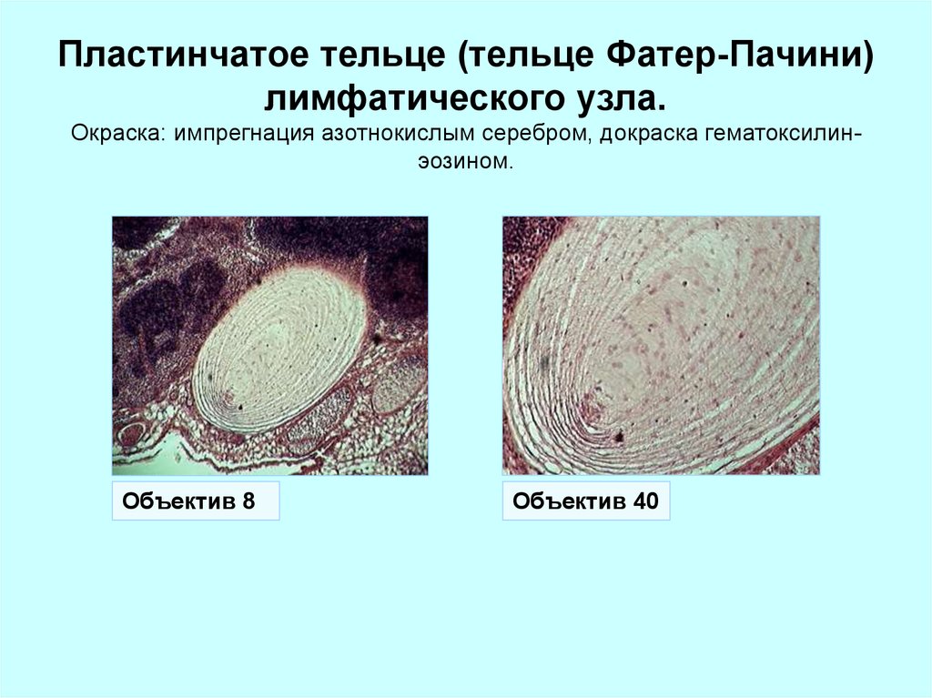 Определите название частей тельца пачини обозначенных на рисунке цифрами 1 и 2