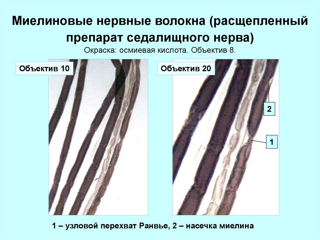 Миелиновые нервные волокна. Миелиновые нервные волокна седалищного нерва. Мякотные миелиновые волокна. Миелиновые волокна осмиевая кислота. Мякотные нервные волокна нерва лягушки.