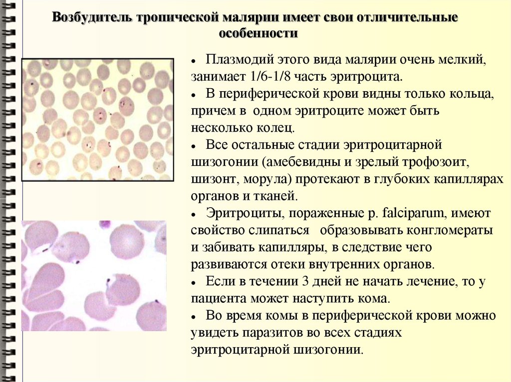 Лечение тяжелой тропической малярии