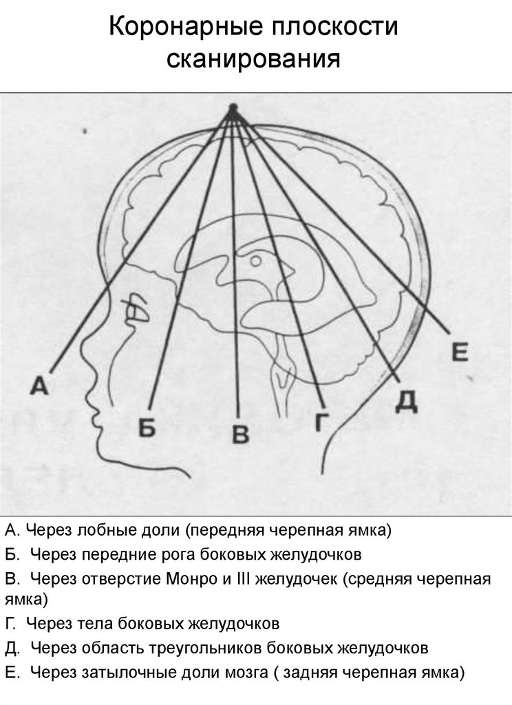 Схема черепно мозговой топографии схема кренлейна