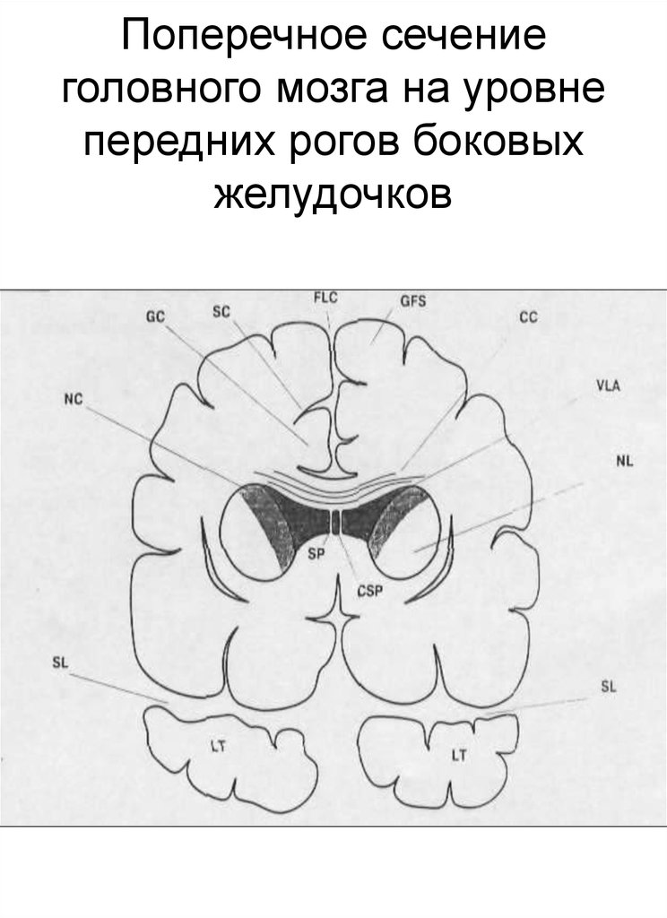 Диаграмма поперечного сечения головного мозга