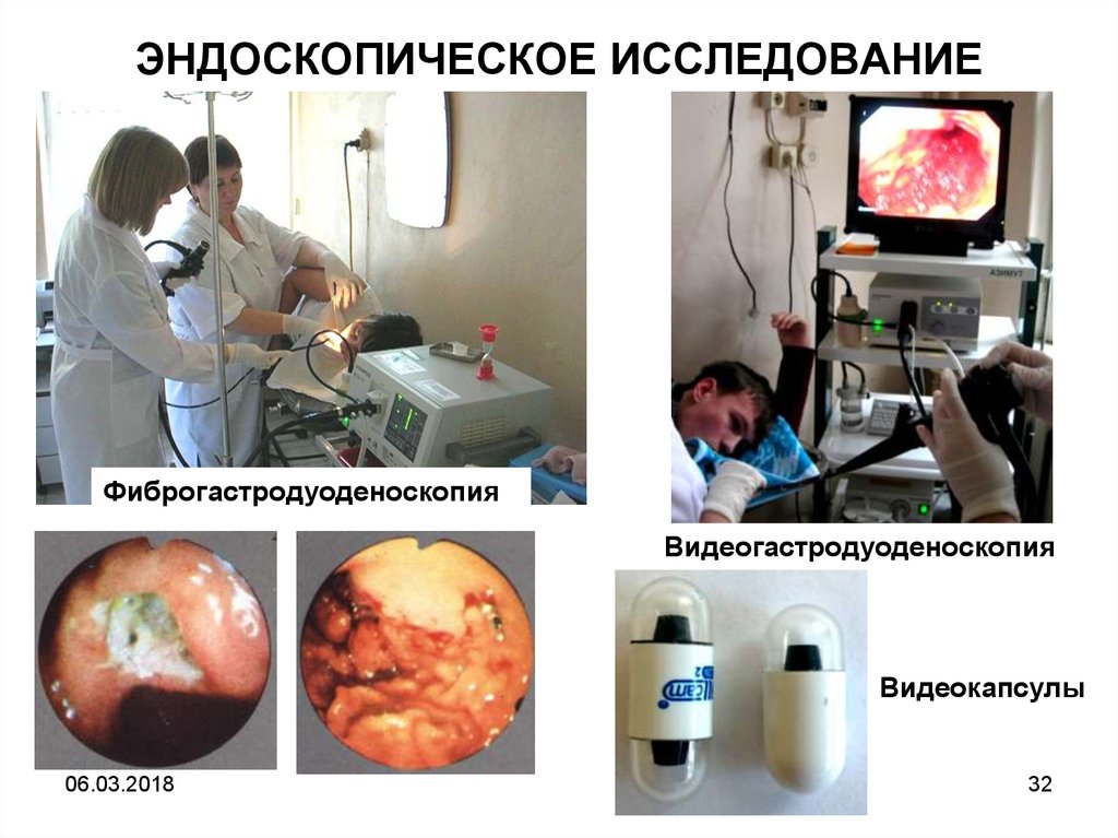 ЭНДОСКОПИЧЕСКОЕ ИССЛЕДОВАНИЕ