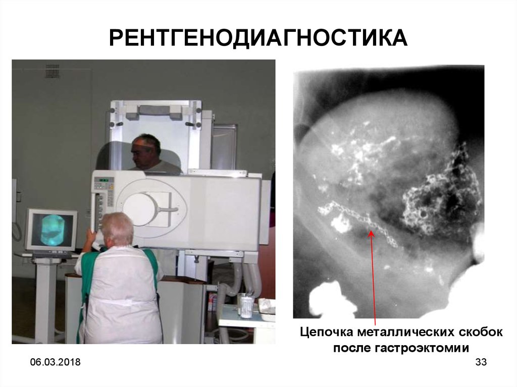 РЕНТГЕНОДИАГНОСТИКА