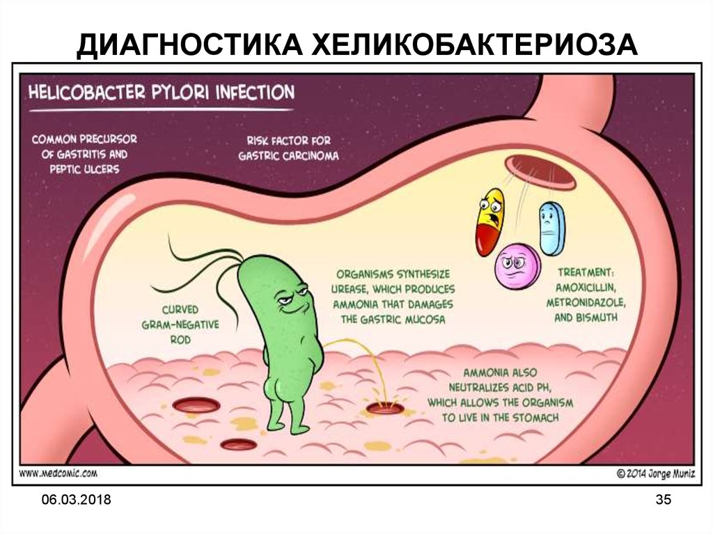 Хеликобактер язык. Helicobacter pylori распространенность. Прыщи при хеликобактер пилори.