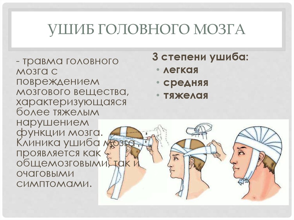 Наличие головной. Ушиб головного мозга клиника. Клиника при ушибе головного мозга. Клиника ушиба головного мозга по степеням. Повреждения головы клиника.