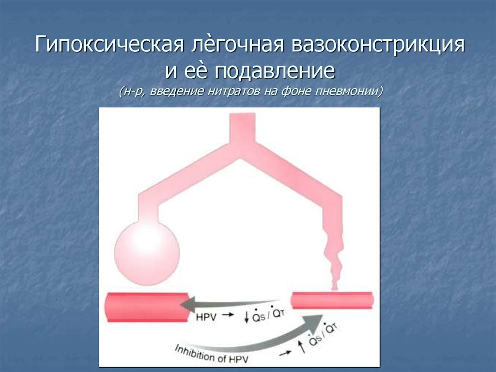 Гипоксическая лѐгочная вазоконстрикция и еѐ подавление (н-р, введение нитратов на фоне пневмонии)