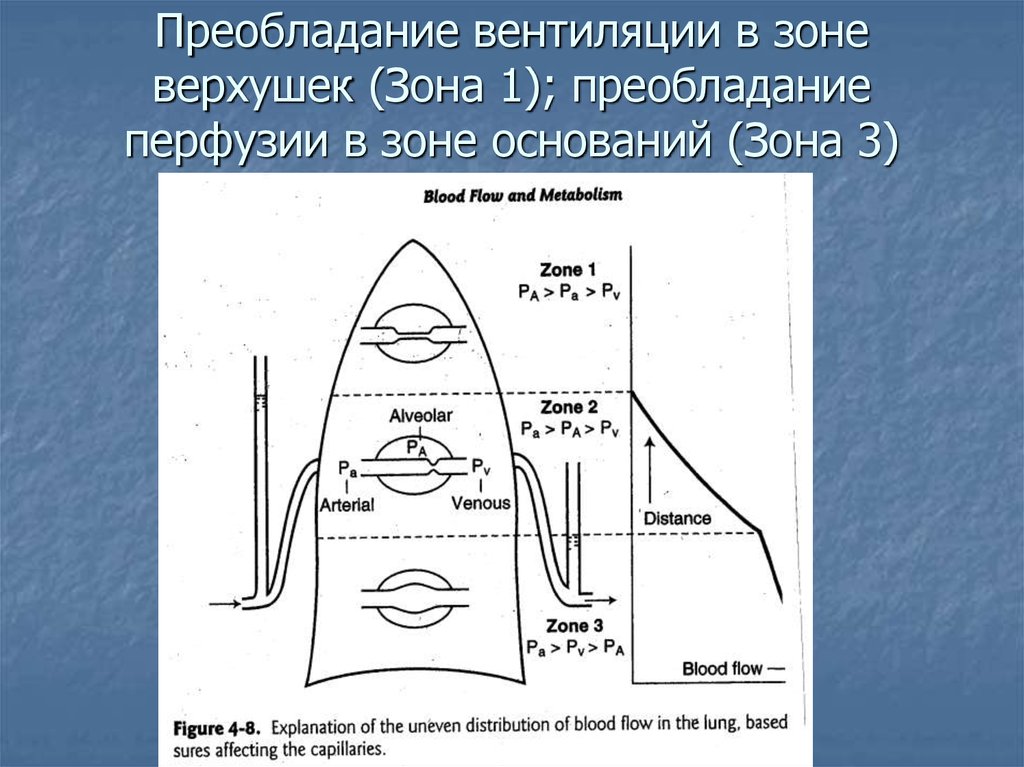 Преобладание вентиляции в зоне верхушек (Зона 1); преобладание перфузии в зоне оснований (Зона 3)
