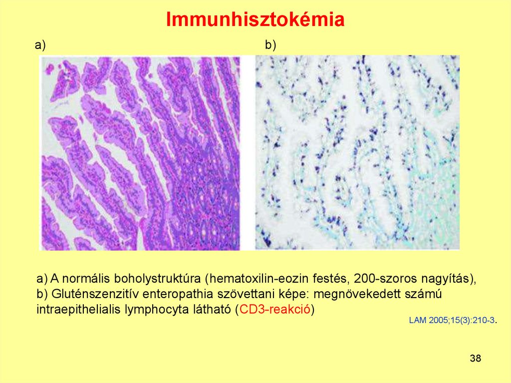 Immunhisztokémia