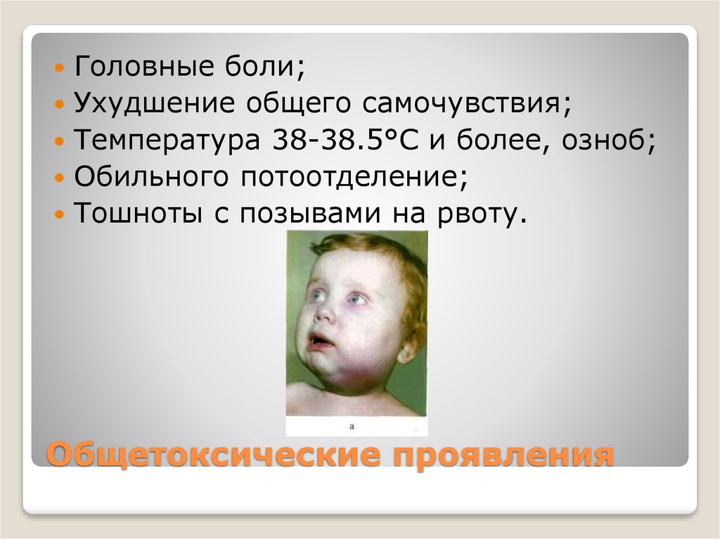 Аденофлегмона это. Аденофлегмона поднижнечелюстной области. Аденофлегмона поднижнечелюстной области дети. Клиническая картина аденофлегмоны.