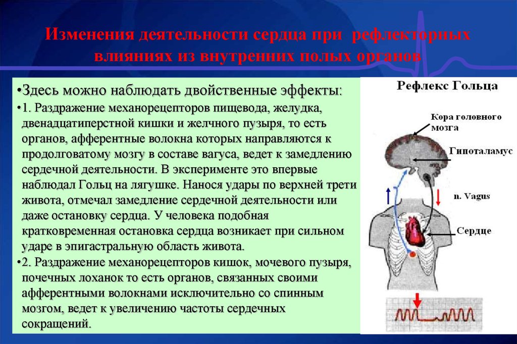 Рефлекс гольца схема