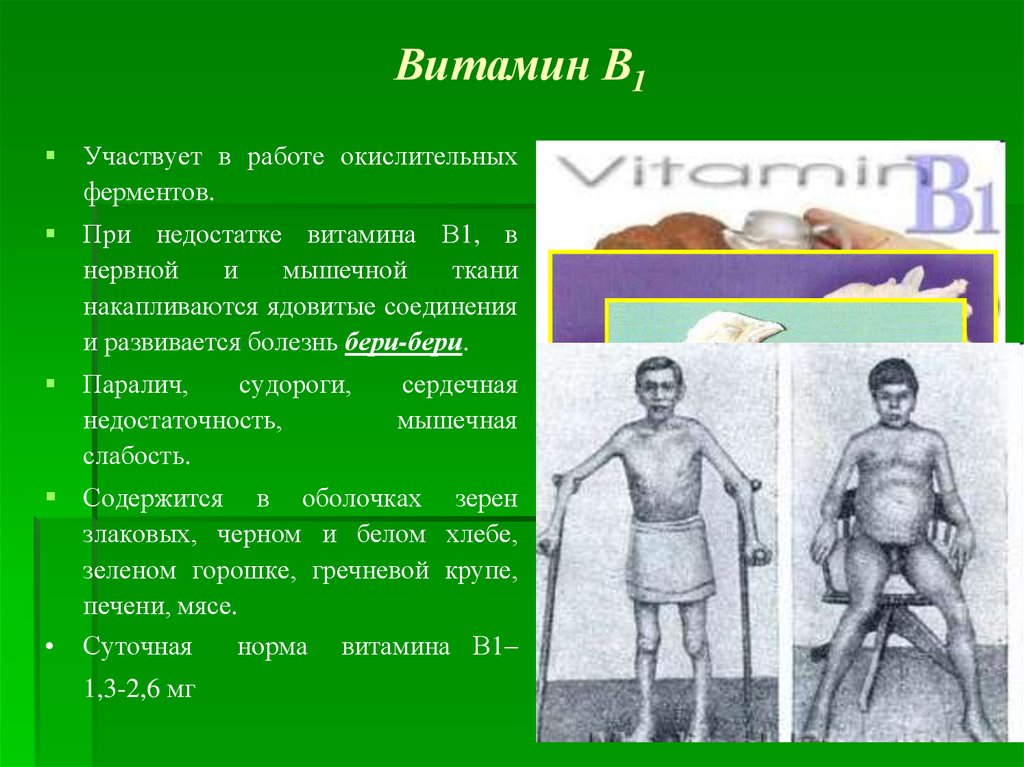 При недостатке заболевание бери бери. Признаки недостатка витамина b1. Дефицит витамина b1 симптомы.
